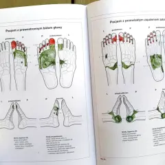 Ilustracje przedstawiające punkty stopy związane z bólem głowy i zapaleniem zatok.